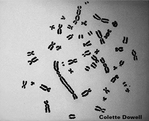 Genetically Damaged Chromosomes Radiation Fukushima Chernobyl Iraq Depleted Uranium Nuclear Energy Radioactive